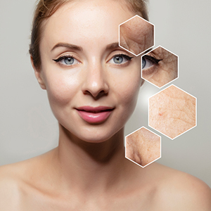 Anti-Aging treatment hyderabad